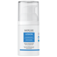 Lesione Nacricare Lesione Nacricare