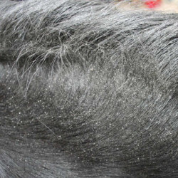 Repellente Animaderm Derfly